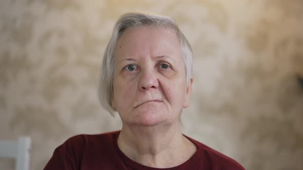 Portrait of a Woman with Facial Paralysis alt