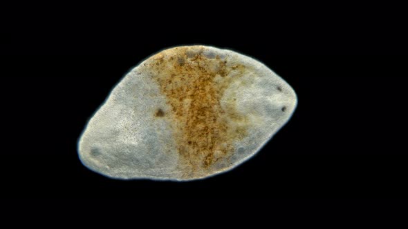 Marine Ciliary Worm Under a Microscope; Most Worms Are Found in the Seas and Fresh Waters alt