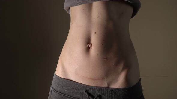 C Section Cesarean Operation Heal After Mother Holding Baby Postpartum Recovery alt