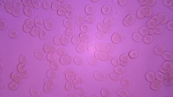 Microscopy, Human Blood, Blood Clots Under Microscope