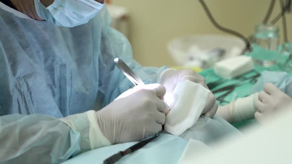 Closeup of Doctors Hands Performing Complex Operation