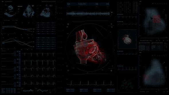 Medical Screen. Cardio 4K