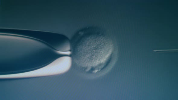 Cells Moving Under Microscope alt