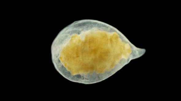 Microturbellaria Worm Under the Microscope, Phylum Platyhelminthes alt