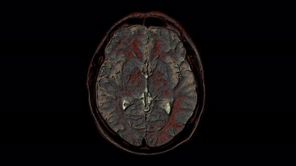 Bulk Multicolored MRI Scans of the Brain and Head To Detect Tumors. Diagnostic Medical Tool alt