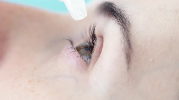 Closeup Girl Drops Eye Drops Install Lenses Moisturizing Using Medical Eyes Drops Suffering From Dry alt