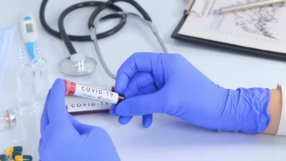 Doctor Hands Analyzing COVID 19 Test Blood
