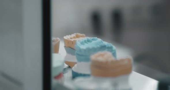 Plaster Models of Teeth in the Dental Laboratory
