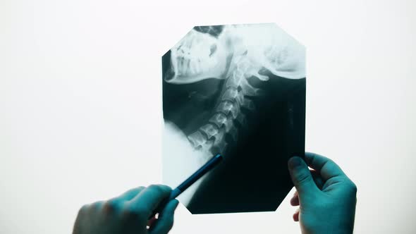 Neck Xray Closeup alt
