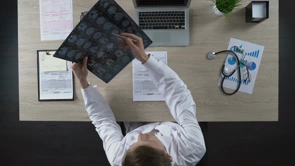 Neurosurgeon Looking at Human Brain MRI to Diagnose Patient Illness, Top View alt