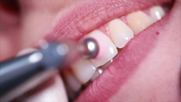 Close Up Shot of a Woman's Mouth Who Brush the Teeth Dentist Help with a Brush alt