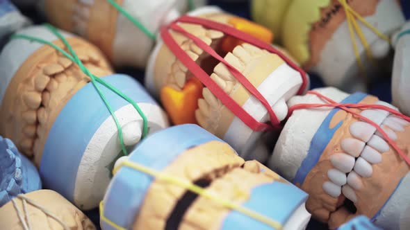 Sculpted Plastic Dentures in Dentistry alt