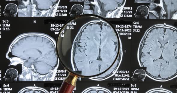 Mri Brain Scan Background, Magnetic Resonance Tomography. The Doctor Examines the Patient's Images alt