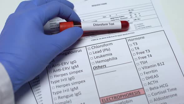 Chloroform Test, Doctor Checking Disease in Lab Blank, Showing Blood Sample alt