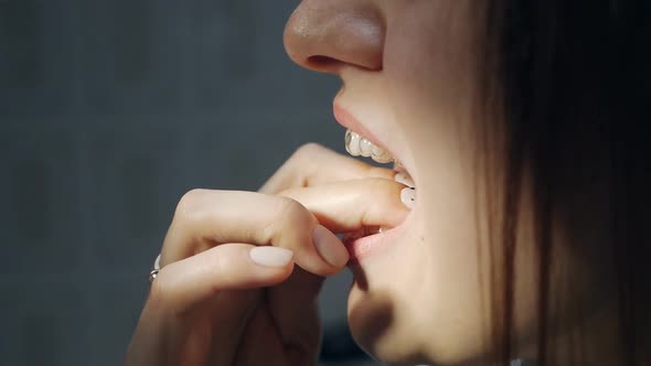 Large Shot of a Patient Trying on Aligners Transparent Plastic Retainers