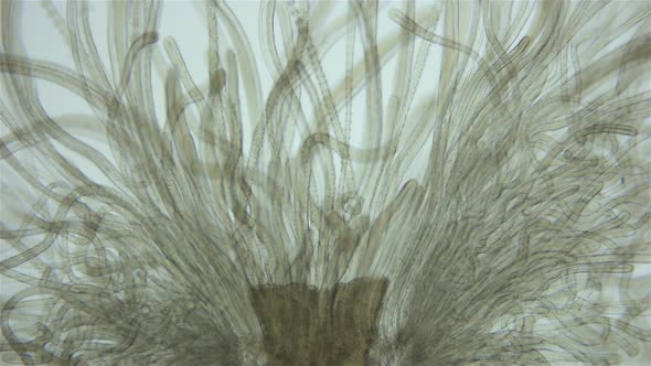 Worm Polychaeta of Family Terebellidae Under the Microscope Phylum Annelida alt