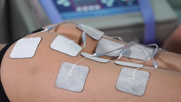 Lady at Electro Stimulation Therapy alt