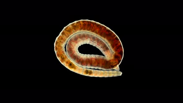 Worm of the Lumbriculidae Family Under a Microscope, Class Clitellata, Oligochaeta Specimen Found  alt