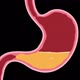 Human Stomach Cartoon - VideoHive Item for Sale