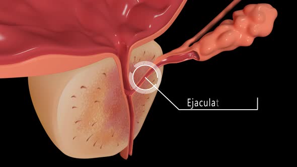 Section Bladder And Prostate Overview by madi7779 | VideoHive