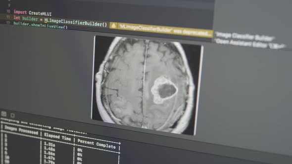 Brain Tumor MRI Dataset Analysis Deep Learning Model Creation on Screen