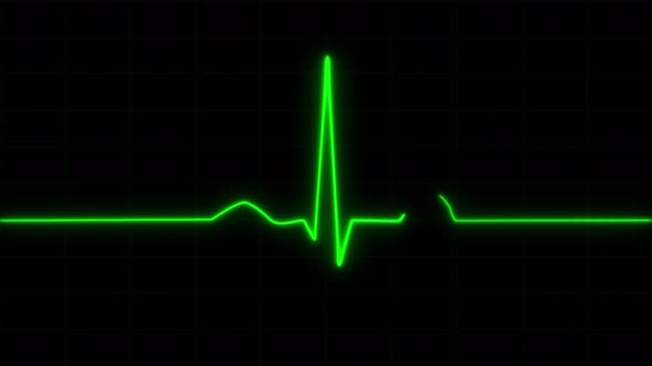 Concept 2-E1 Realistic Heart Pulse Monitor Animation alt