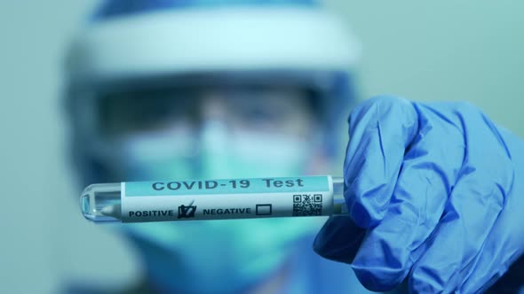 Covid-19 positive test sars – cov-2 epidemic