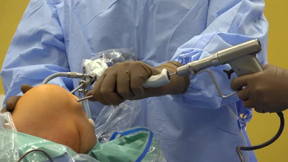 Arthroscopy and Knee Ligament Surgery 12