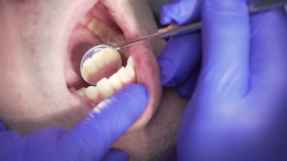Dentist Conducts Dental Hygiene To the Patient