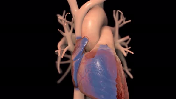 Animated Congestive Heart Failure 3d alt
