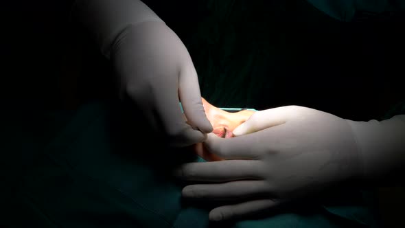 Eye Surgery With Laser alt