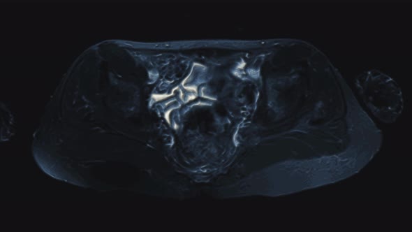 Voluminous Color MRI of the Female Pelvic Organs, Abdominal Cavity, Gastrointestinal Tract and alt