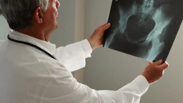 Male doctor examining an x-ray alt