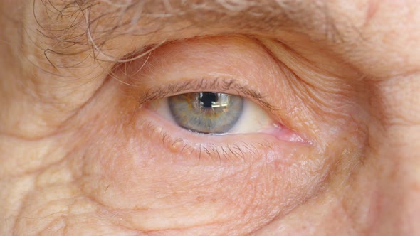 The Eye of a Very Old Man Closeup alt