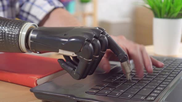Young Man with a Prosthetic Arm Is Working at a Laptop Close Up alt