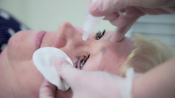 An ophthalmologist instills anesthetic drops into the eye of an adult woman before a treatment proce