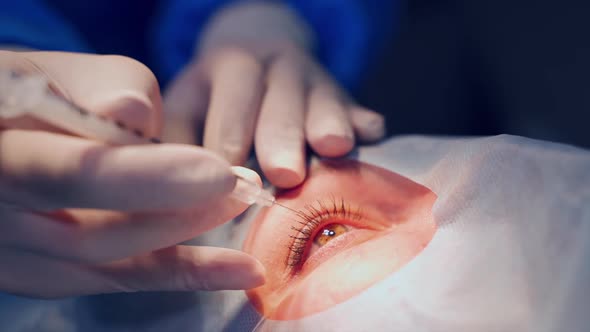 Patient under sterile cover. Close up detail of surgery of the eye alt