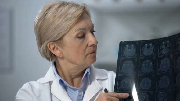 Mature Female Radiologist Showing Brain X-Ray and Shaking Head, Bad Diagnosis