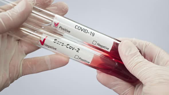 A Virologist Holds in Her Hands Two Test Tubes with a Blood Sample Infected with a Coronovirus alt