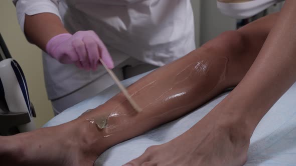 Procedure for Applying a Special Gel Before Laser Hair Removal in a Beauty Salon