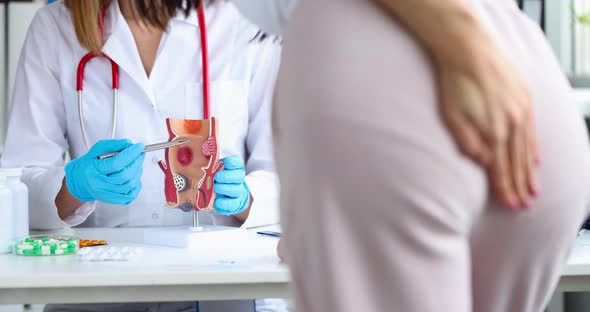 Doctor Holds a Model of Unhealthy Lower Rectum with Inflamed Vascular Structures alt