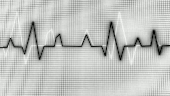 New Black Color Heartbeat Signal Animation alt