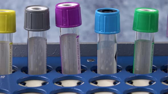 Empty test tubes with colorful caps in a tray on a blue background