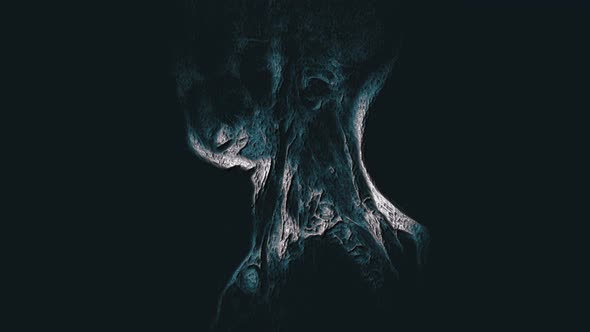 Voluminous Color MRI of the Cervical Spine, Detection of Protrusions and Hernias alt