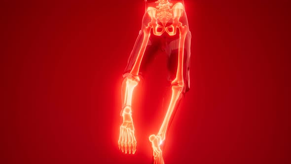 Human Skeleton Radiography Medical Scan