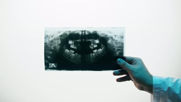 Jaw Xray Closeup alt