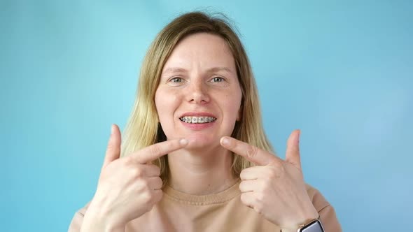 Young Woman with Dental Braces Smiling Isolated on Blue Colour Background alt