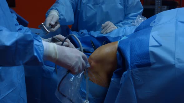 Knee Surgery, Arthroscopy