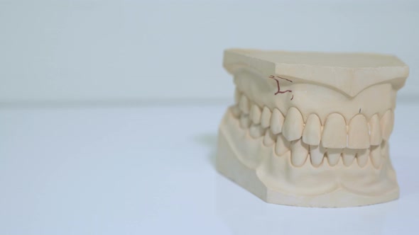Dental mould alt