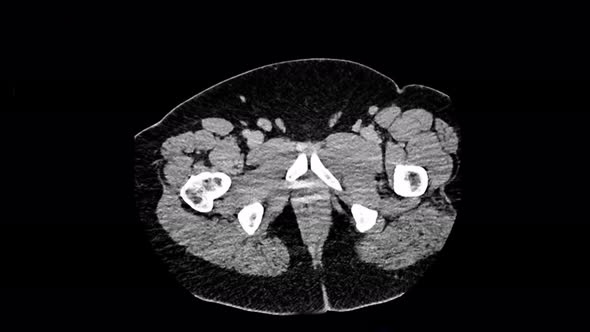 Xray Visualization Head Views of MRI Scan Medical Exam alt